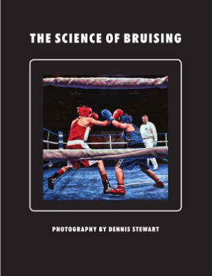 The Science of Bruising